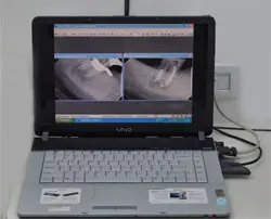 Radiografia digital