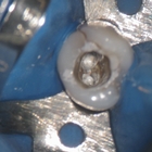 Qualificação dentinária